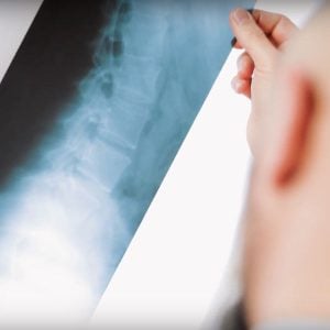 diagnoza-osteopaty-wypadek